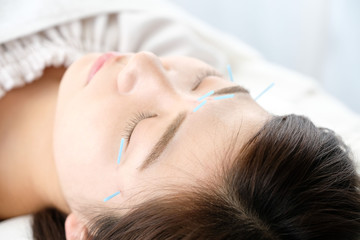 美容鍼の効果とは: BIHADAエステ＆美容鍼灸が提供する美の秘密|美容鍼灸専門院 BIHADA