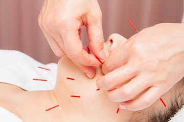 美容鍼は月一の施術でも効果が出る？町田のBIHADAが詳しく解説する内側からの美容法とは |BIHADAエステ＆美容鍼灸